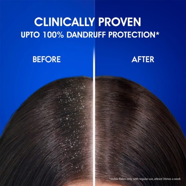 Head & Shoulders Cool Menthol Anti Dandruff Shampoo for Women & Men, 1L